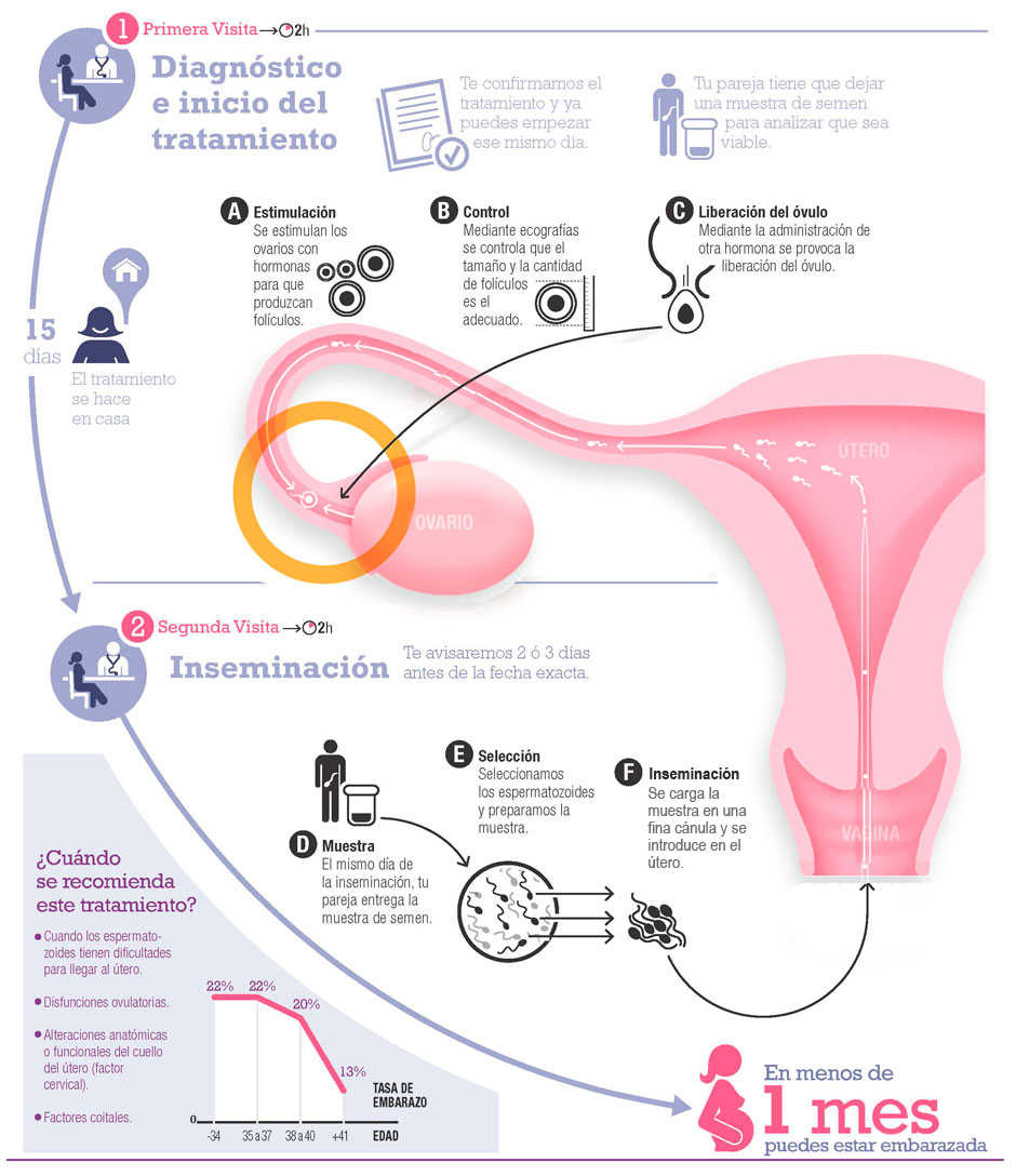 ¿Qué es la Inseminación Artificial?