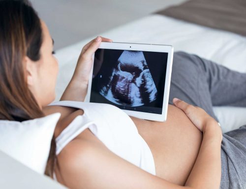 La amniocentesis: qué es y cuándo se recomienda