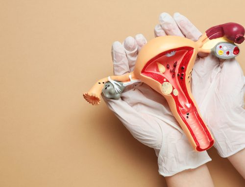 ¿Qué es el endometrio engrosado o hiperplasia endometrial?