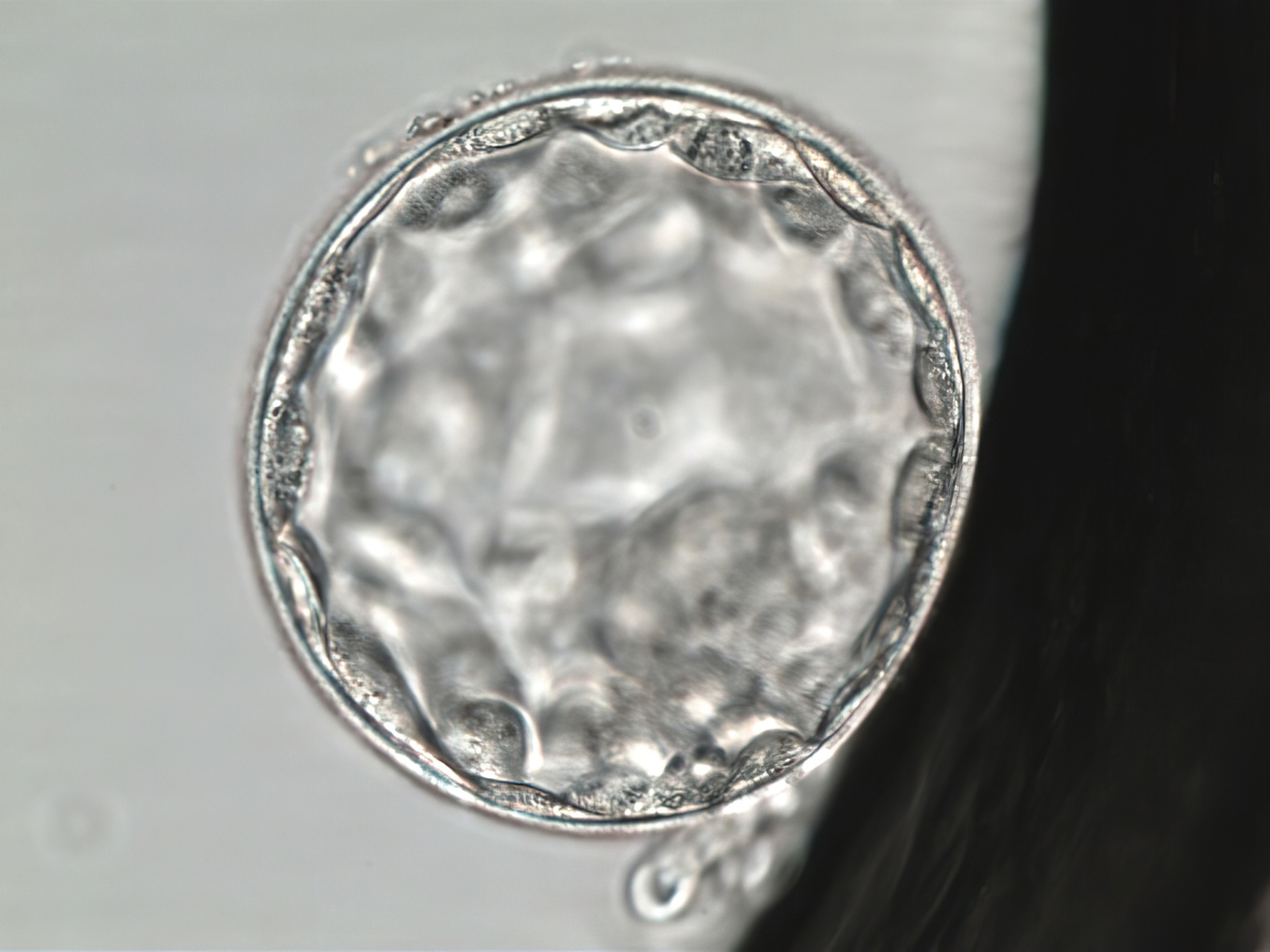 Hatched human blastocyst. Grade AA. Fifth day of development. Viewed under the microscope.